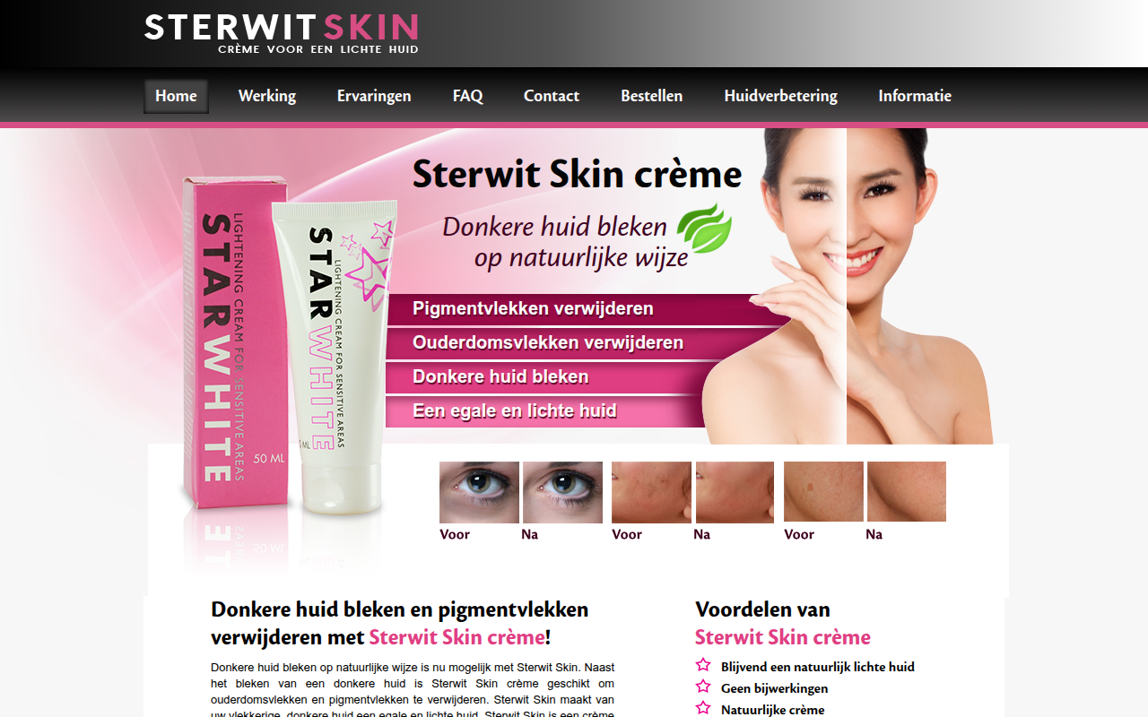 Screenshot van sterwitskin.nl